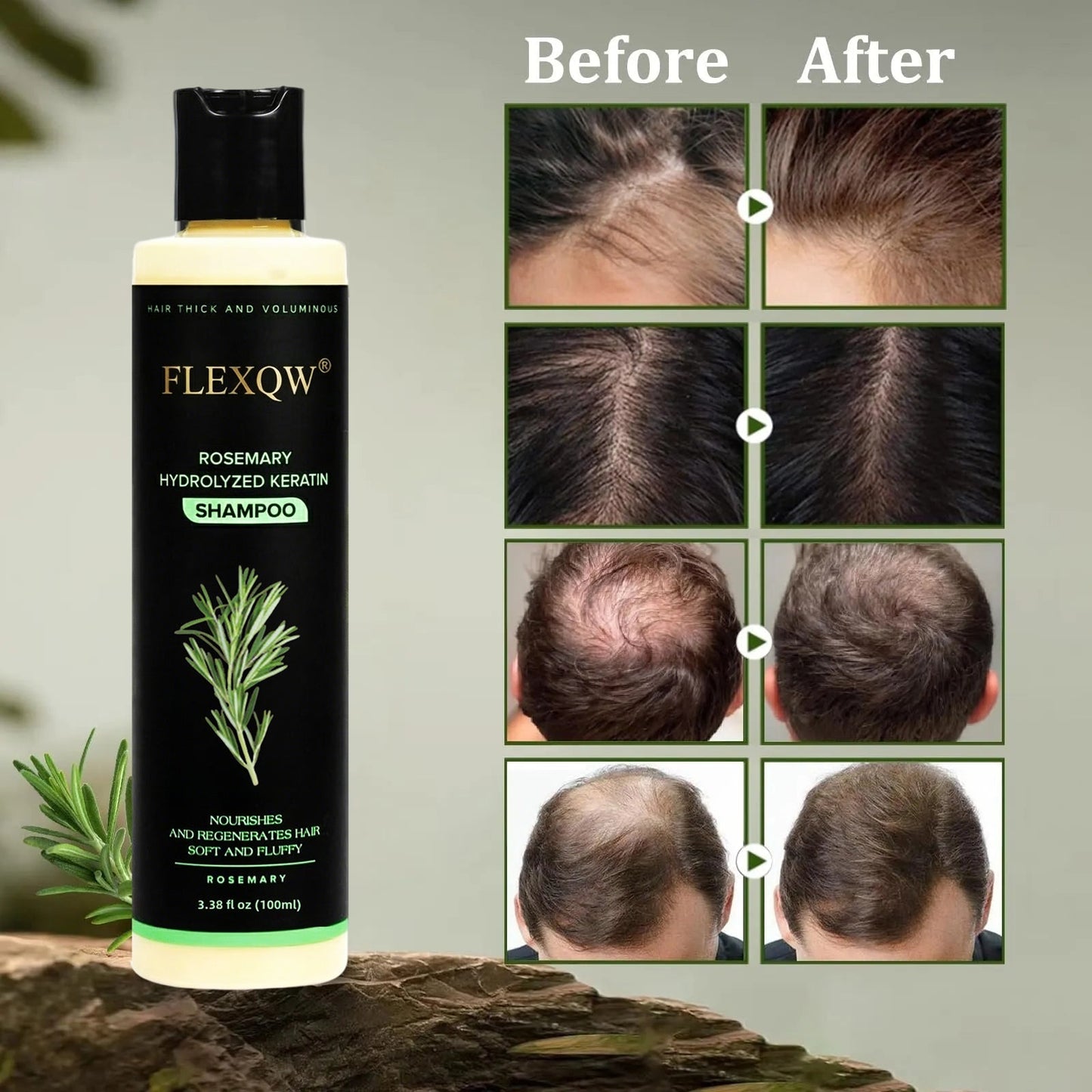🌸Organic Rosemary Keratin Hair Growth Shampoo