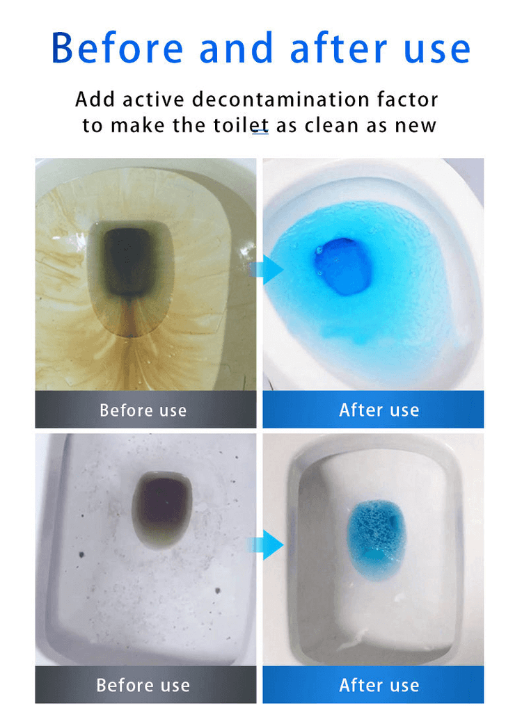 ⏰Last Day Surprise Price: Buy 1 Get 1 Free🔥SINK & DRAIN CLEANER